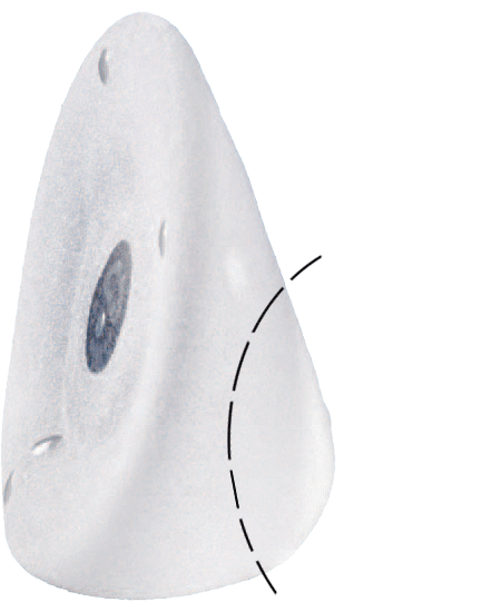 allergan natrelle 510